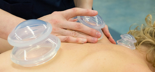 How To Use Silicone Cupping Therapy For Pain Relief