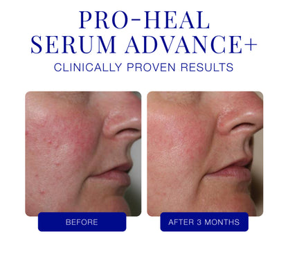 Isclinical pro heal serum